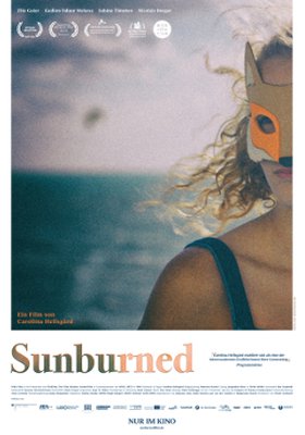 Sunburned Sunburned